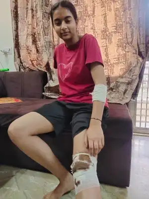 दिल्ली में आवारा कुत्तों का आंतक, रोहिणी में बच्ची व किशोरी पर हमला