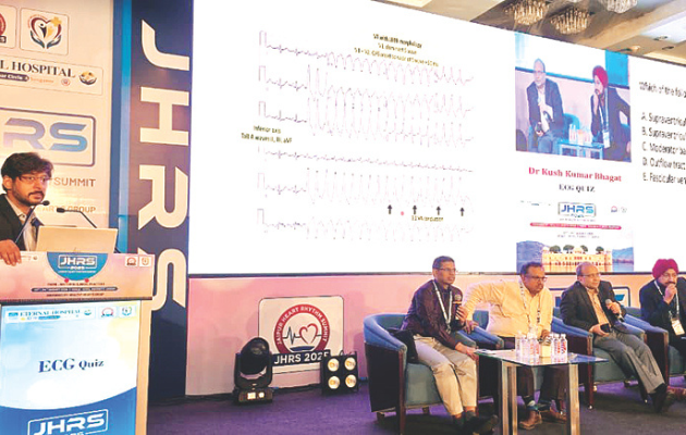 एआई की मदद से ईसीजी से हार्ट अटैक का पूर्वानुमान संभव