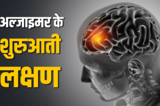 अल्जाइमर रोग के लक्षणों के बारे में जानें अल्जाइमर रोग के लक्षणों के बारे में जानें