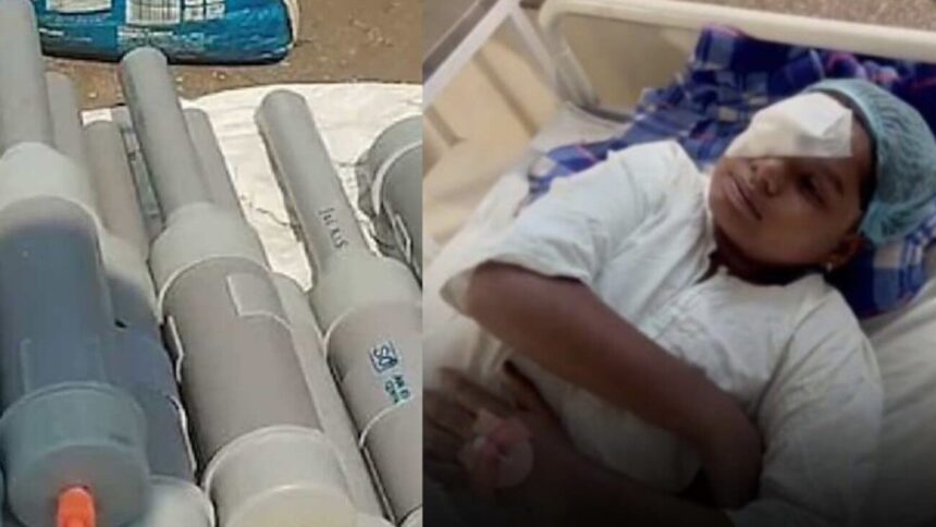 भोपाल में कार्बाइड गन से घायल मरीजों का सफल इलाज