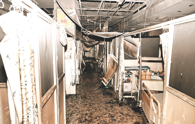 ट्रोमा सेंटर में आग की घटना के 20 दिन बाद भी रिपोर्ट नहीं आई